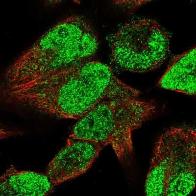 Immunocytochemistry/ Immunofluorescence: STAC3 Antibody [NBP2-55072]