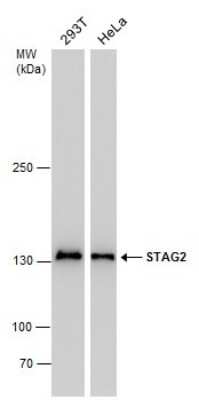 Western Blot: STAG2 Antibody (1417) [NBP2-43823]