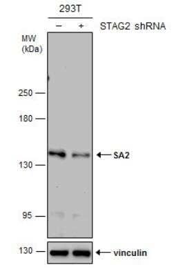 Western Blot: STAG2 Antibody (1417) [NBP2-43823]