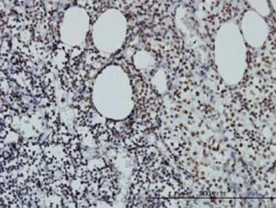 Immunohistochemistry-Paraffin: STAG2 Antibody (3C6) [H00010735-M01]