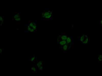Immunocytochemistry/ Immunofluorescence: STAG2 Antibody (3H4) [NBP3-15155]