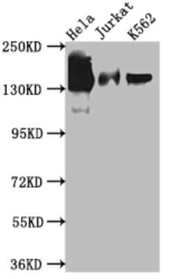 Western Blot: STAG2 Antibody (3H4) [NBP3-15155]