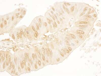 Immunohistochemistry: STAG2 Antibody [NBP1-30473]