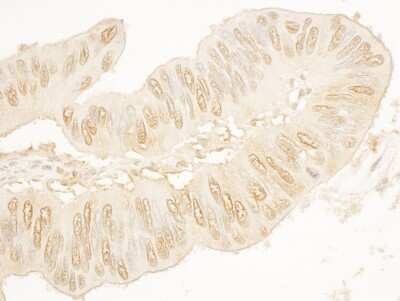 Immunohistochemistry-Paraffin: STAG2 Antibody [NBP1-30472]
