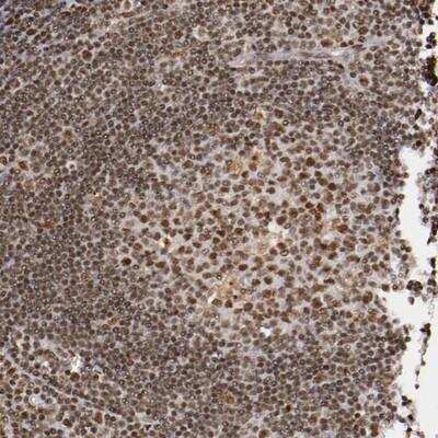 Immunohistochemistry-Paraffin: STAG2 Antibody [NBP1-87096]