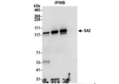 Immunoprecipitation: STAG2 Antibody [NB100-301]