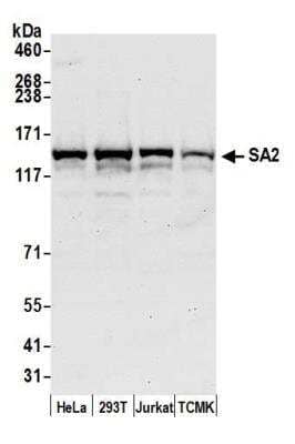 Western Blot: STAG2 Antibody [NB100-300]