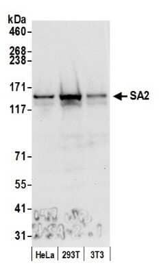 Western Blot: STAG2 Antibody [NB100-301]