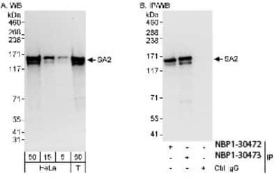 Western Blot: STAG2 Antibody [NBP1-30472]