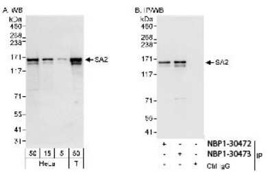 Western Blot: STAG2 Antibody [NBP1-30473]