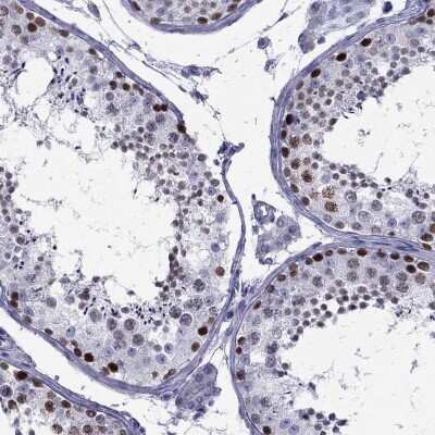 Immunohistochemistry-Paraffin: STAG3 Antibody [NBP2-38851]