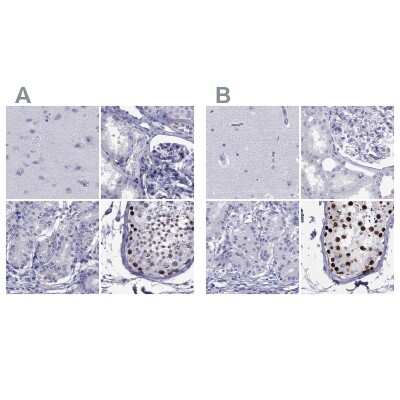 Immunohistochemistry-Paraffin: STAG3 Antibody [NBP2-38851]