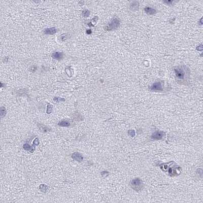 Immunohistochemistry-Paraffin: STAG3 Antibody [NBP2-38851]