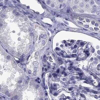 Immunohistochemistry-Paraffin: STAG3 Antibody [NBP2-38851]