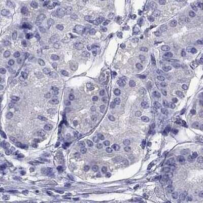 Immunohistochemistry-Paraffin: STAG3 Antibody [NBP2-38851]