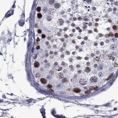 Immunohistochemistry-Paraffin: STAG3 Antibody [NBP2-38851]