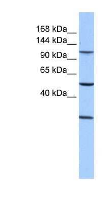 Western Blot: STAG3 Antibody [NBP1-58087]