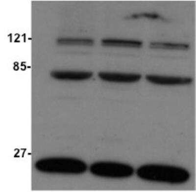 Western Blot: STAG3 Antibody [NBP1-58087]