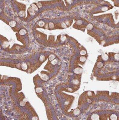 Immunohistochemistry-Paraffin: STAM-1 Antibody [NBP2-38514]
