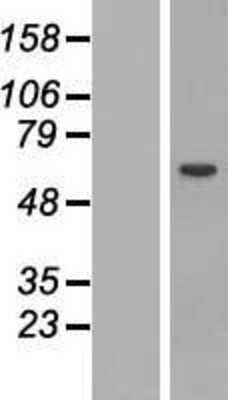 Western Blot: STAM-1 Overexpression Lysate [NBP2-08004]