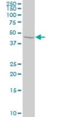 Western Blot: STAM2 Antibody (1A10) [H00010254-M01]