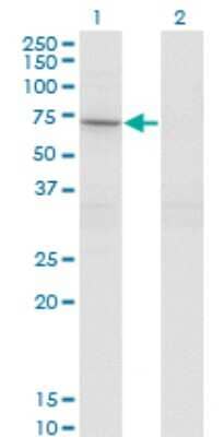 Western Blot: STAM2 Antibody (1A10) [H00010254-M01]