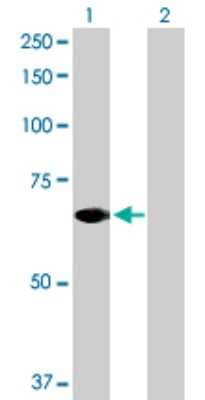 Western Blot: STAM2 Antibody [H00010254-D01P]