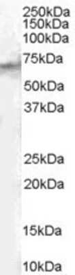 Western Blot: STAM2 Antibody [NB100-2838]