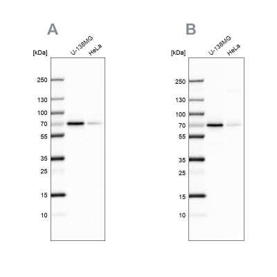 Western Blot: STAM2 Antibody [NBP1-83288]