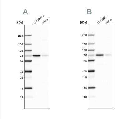 Western Blot: STAM2 Antibody [NBP1-83289]