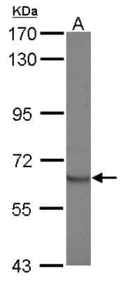 Western Blot: STAM2 Antibody [NBP2-20500]