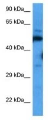 Western Blot: STAM2 Antibody [NBP3-09995]