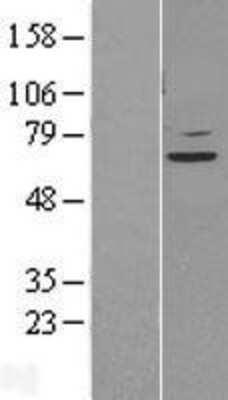 Western Blot: STAM2 Overexpression Lysate [NBL1-16510]