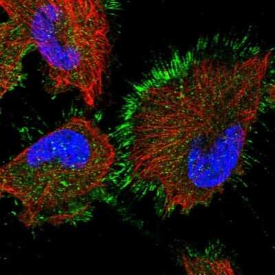 Immunocytochemistry/ Immunofluorescence: AMSH-LP Antibody [NBP1-89135]