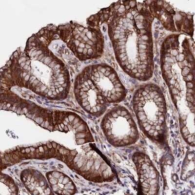 Immunohistochemistry-Paraffin: AMSH-LP Antibody [NBP1-89135]