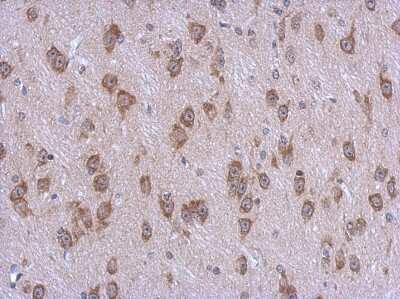 Immunohistochemistry-Paraffin: AMSH-LP Antibody [NBP2-20501]
