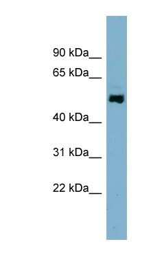 Western Blot: AMSH-LP Antibody [NBP1-56334]