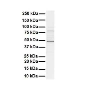 Western Blot: AMSH-LP Antibody [NBP1-56334]