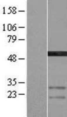 Western Blot: AMSH/STAMBP Overexpression Lysate [NBP2-04466]