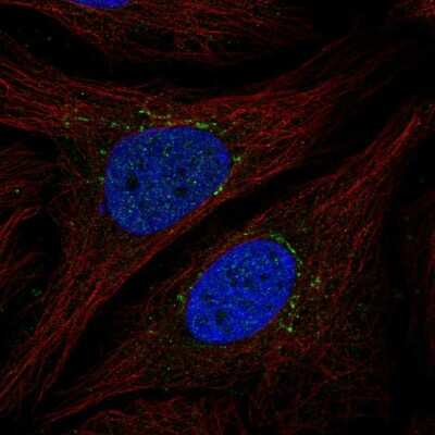 Immunocytochemistry/ Immunofluorescence: STAMP2/STEAP4 Antibody [NBP2-56536]