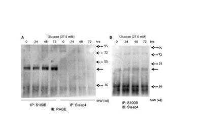 Immunoprecipitation: STAMP2/STEAP4 Antibody [NB100-68162]