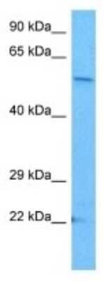 Western Blot: STAMP2/STEAP4 Antibody [NBP3-10071]