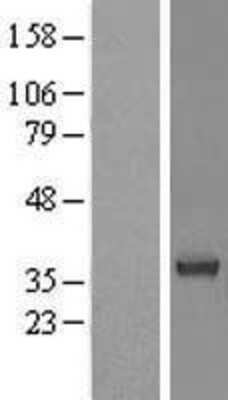 Western Blot: BRDG1/STAP-1 Overexpression Lysate [NBL1-16514]