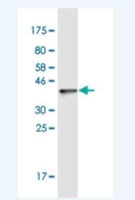 Western Blot: STAP2 Antibody (6C7) [H00055620-M03-100ug]