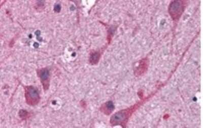 Immunohistochemistry-Paraffin: STAP2 Antibody [NB300-987]