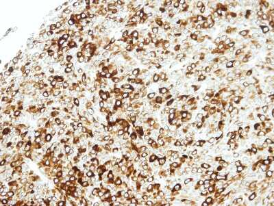 Immunohistochemistry-Paraffin: STAP2 Antibody [NBP1-33643]