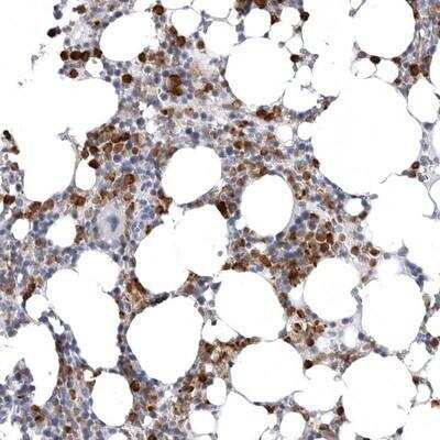 Immunohistochemistry-Paraffin: STAP2 Antibody [NBP1-88585]