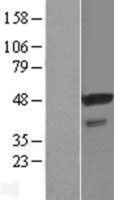 Western Blot: STAP2 Overexpression Lysate [NBL1-16515]