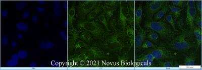Immunocytochemistry/ Immunofluorescence: STARD10 Antibody - BSA Free [NBP2-78818]