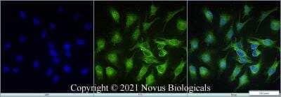 Immunocytochemistry/ Immunofluorescence: STARD10 Antibody - BSA Free [NBP2-78818]